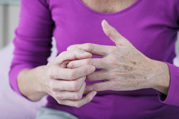 Cómo prevenir la artrosis